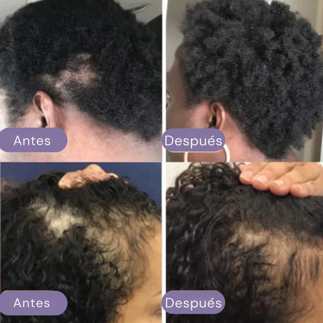 Aceite natural para el crecimiento del cabello