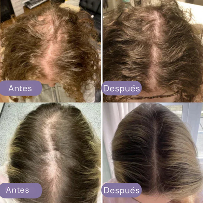 Aceite natural para el crecimiento del cabello